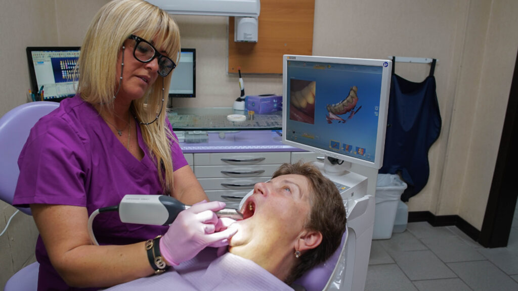 Digital Impression Scan of Teeth: Advanced technology captures precise tooth details for personalized dental treatments.