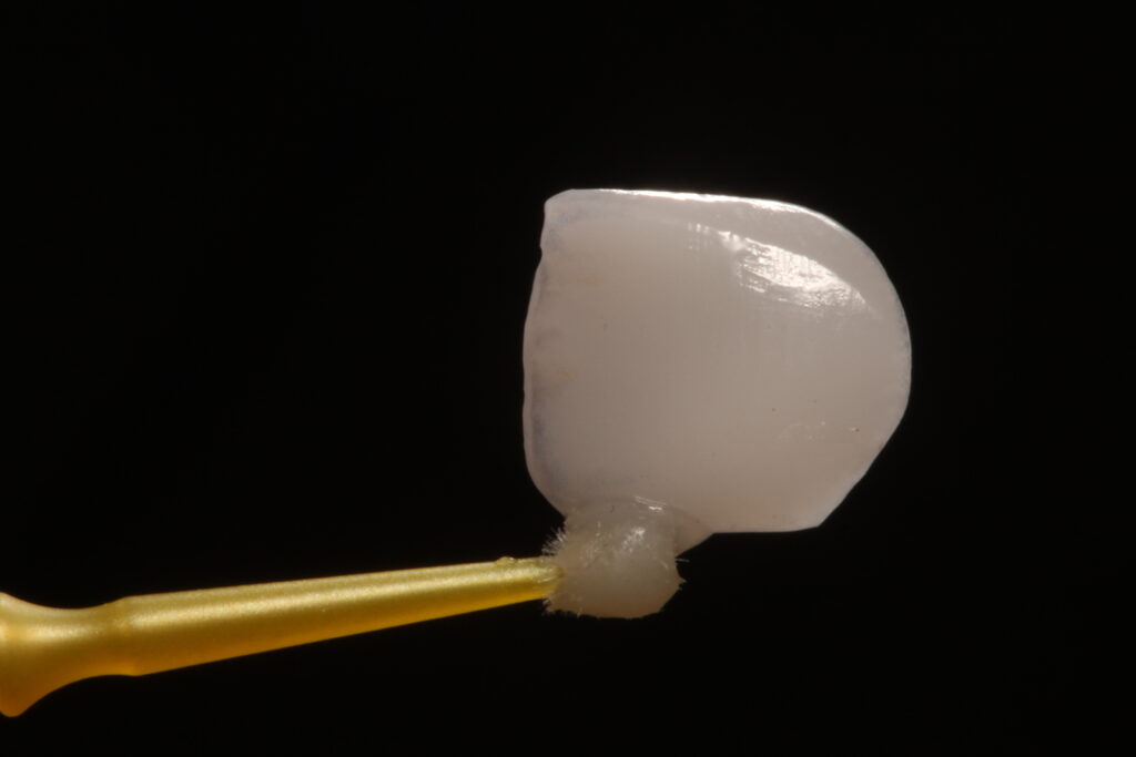 Porcelain Dental Veneer