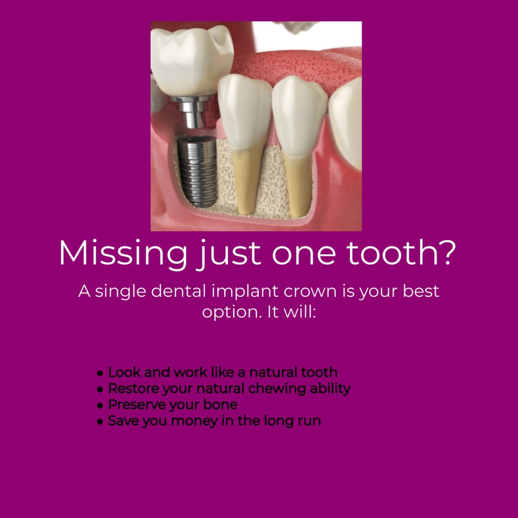 Single Dental Implant Illustration as one of the tooth replacement options