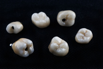 Implant-Supported Crowns for Secure Smile Restoration
