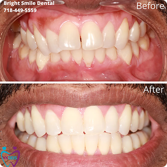 flexible Payment Plans