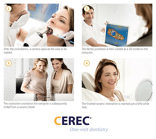 Cerec technology img