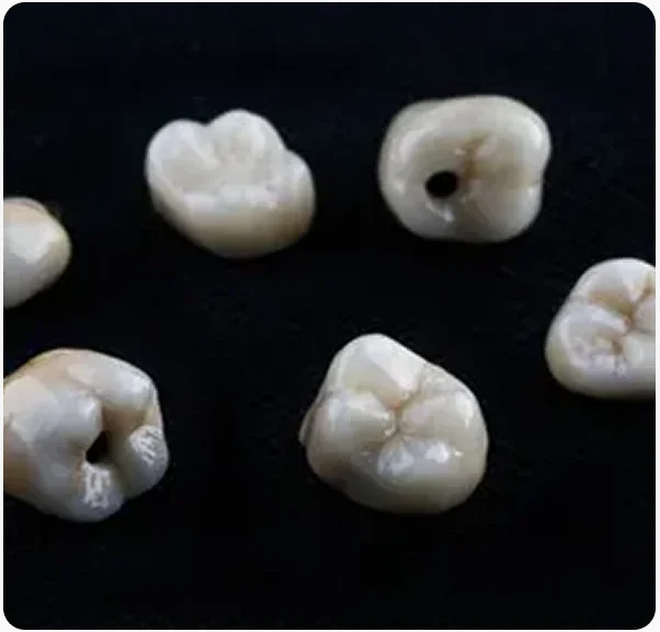Types of dental crowns img
